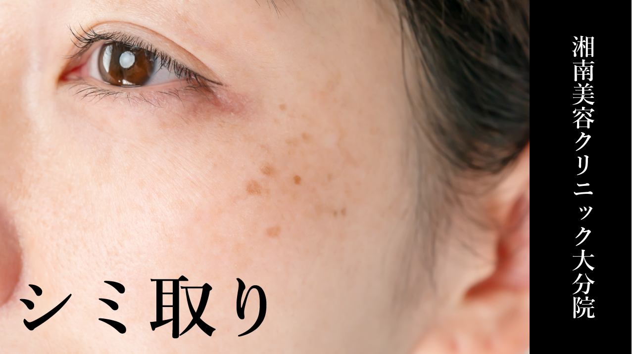 【大分駅近くの美容皮膚科】初診・再診料無料！シミ・肝斑・くすみ治療なら湘南美容クリニック大分院