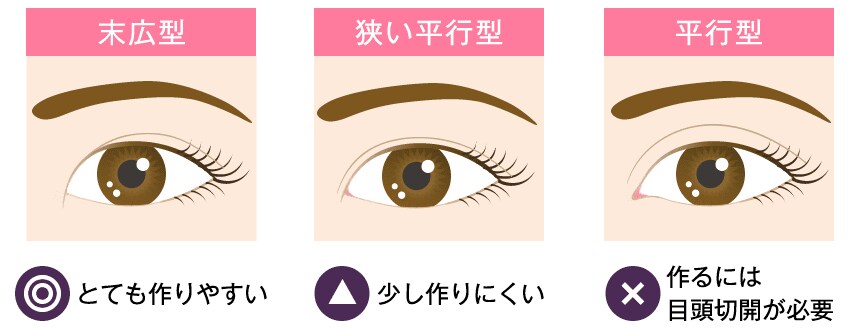 二重を平行型にしたい方はおすすめ