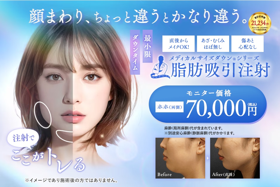 脂肪吸引注射