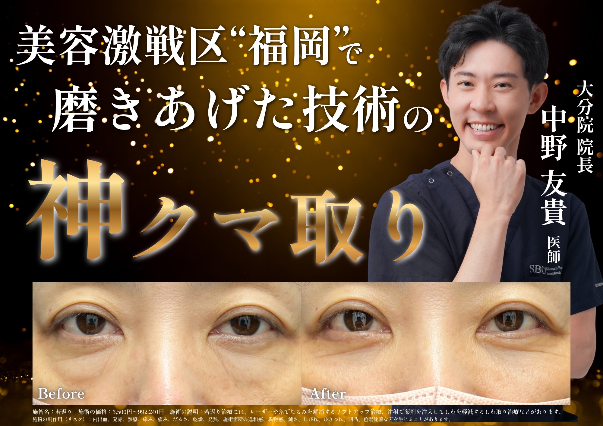 【大分のクマ取りドクター】クマ取りするなら若返りのプロ SBC大分院 中野院長にお任せください！
