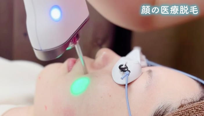 医療脱毛（顔）