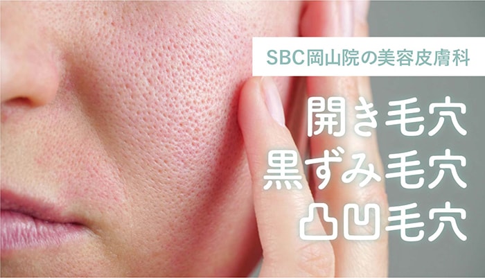 開き毛穴・黒ずみ毛穴・凸凹毛穴