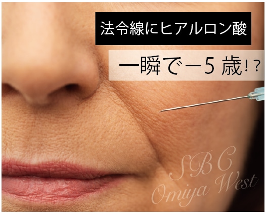 切らずに手軽な若返り術✨