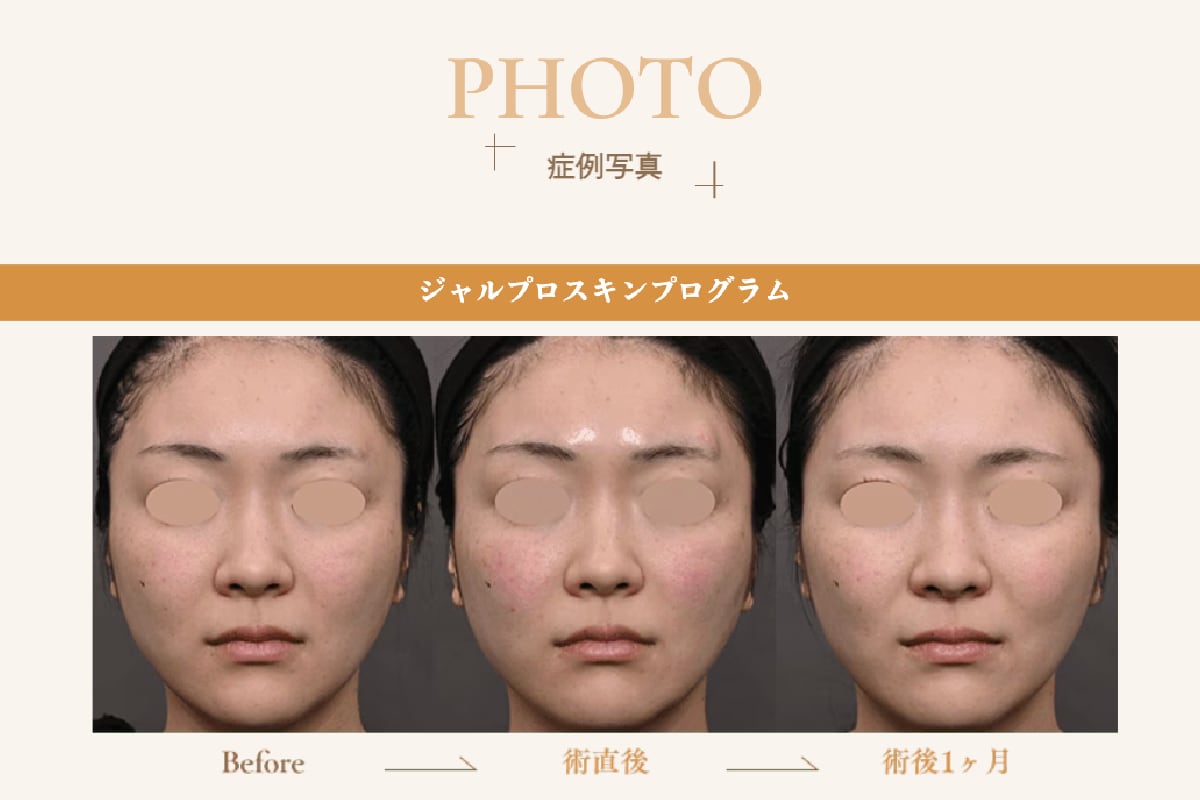 症例写真