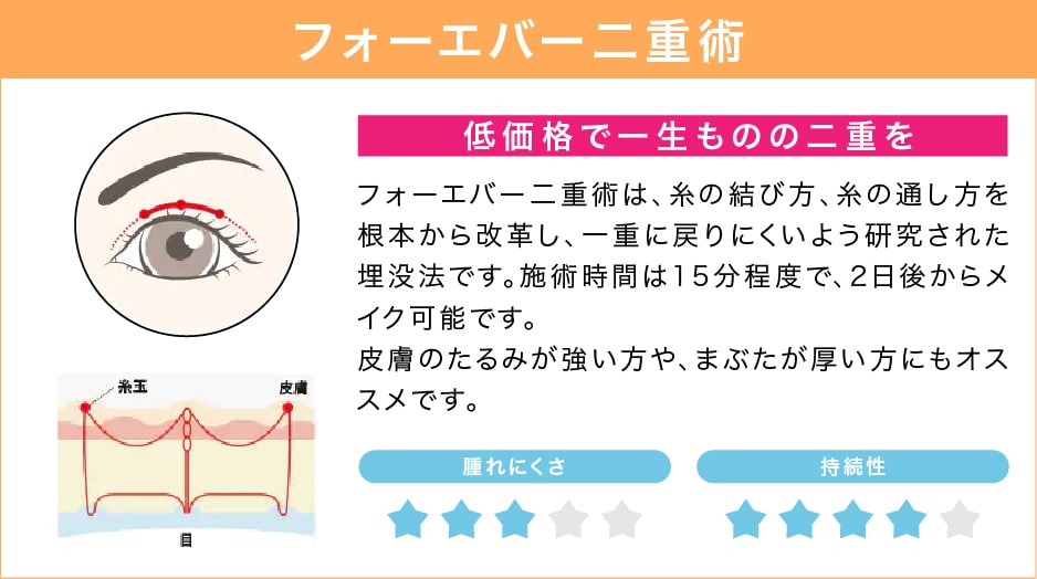 フォーエバー二重術