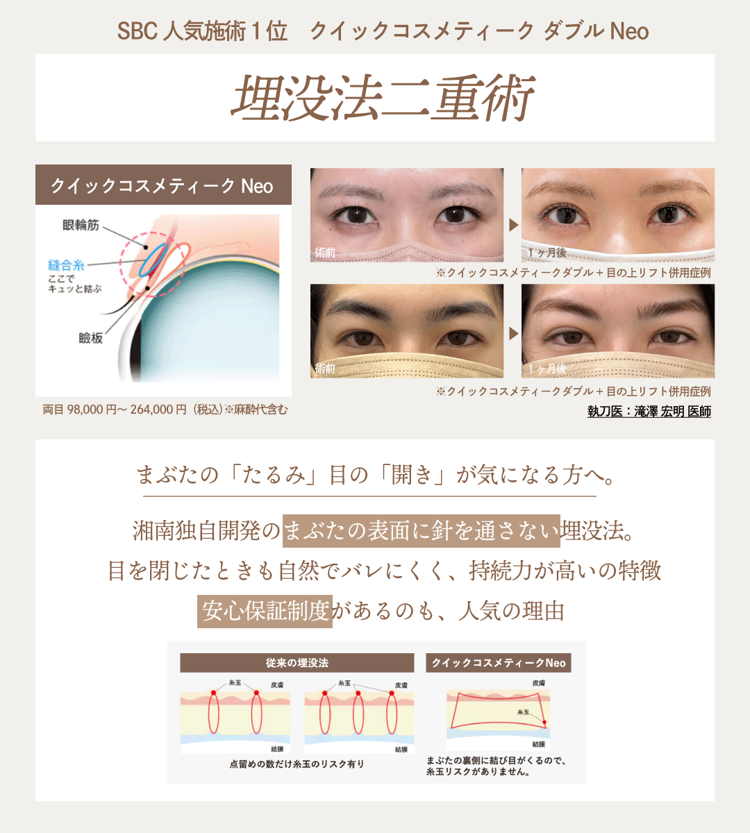 埋没二重術