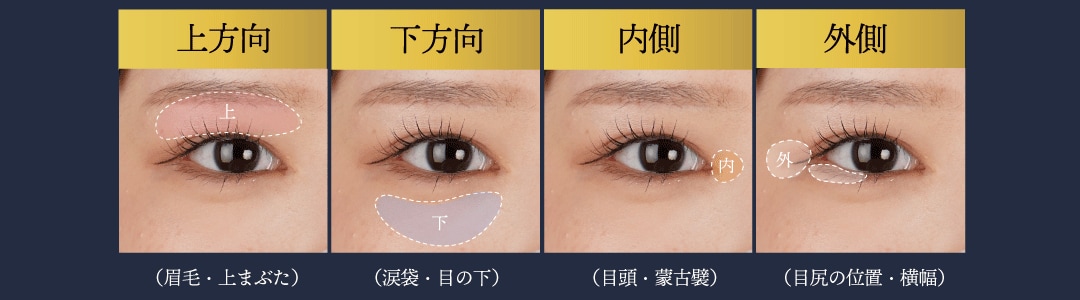Q.眉下切開でツリ目になることはありますか？