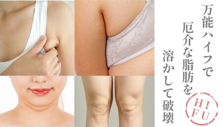 痛そうな施術は受けたくないけど<br />
「どうにかしたい」に応えます！