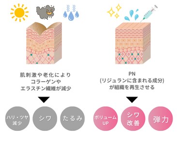 肌育治療が必要な理由✨