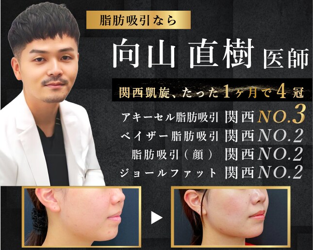顔の脂肪吸引において、圧倒的な実績を持つ向山院長。