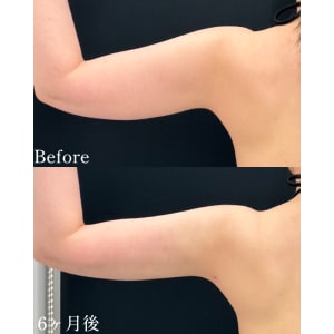 症例3