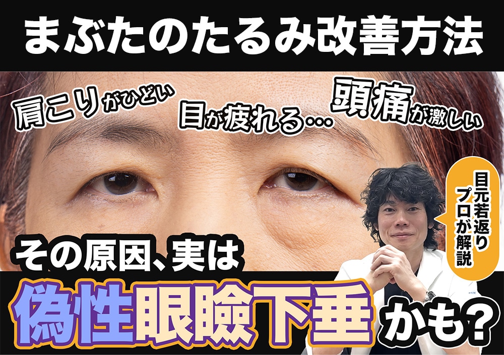 【まぶたのたるみ改善】これって眼瞼下垂？目の疲れ・肩こり・頭痛解消の原因と対処法を究明！