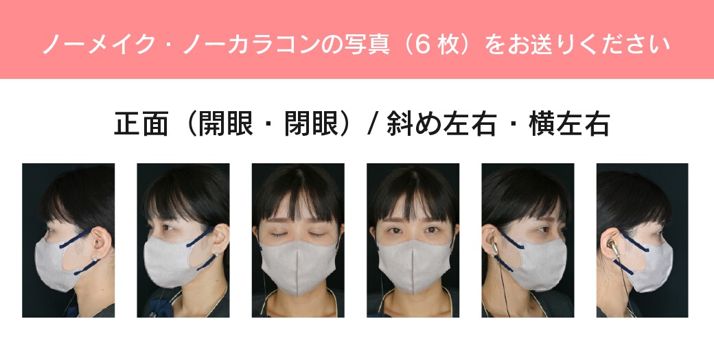 ①野口医師にMysbcからメールで診断