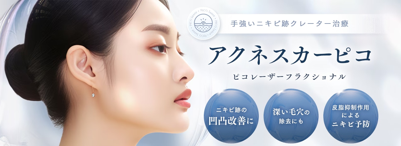★アクネスカーピコ★