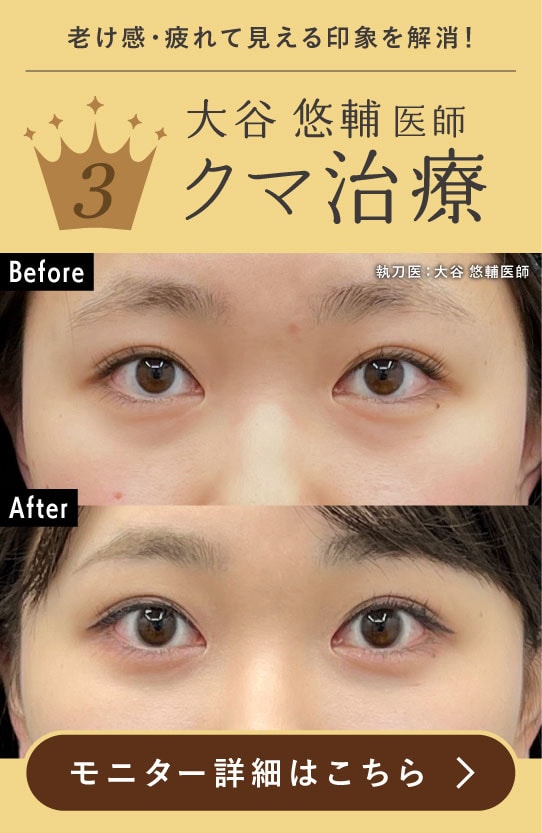 【クマ治療】気になる目の下のクマ、改善できます