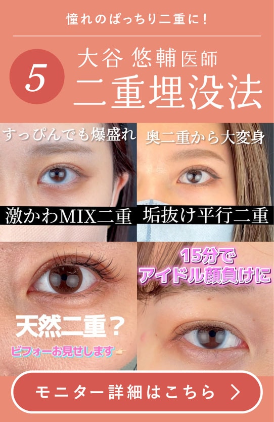 【二重】すっぴんでも盛れる♡理想の目元に！