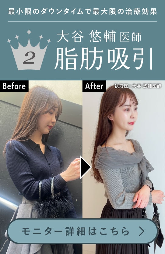 【脂肪吸引】女性らしいボディラインになれると人気！大谷先生の脂肪吸引