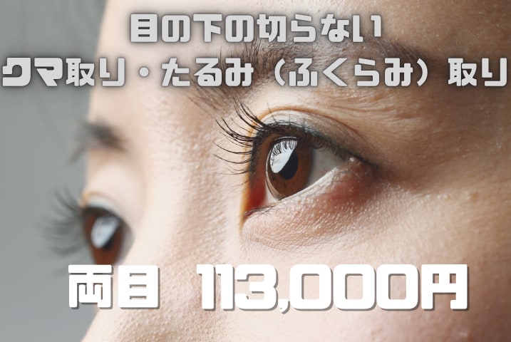目の下の切らないクマ取り・たるみ（ふくらみ）取り：113,000円