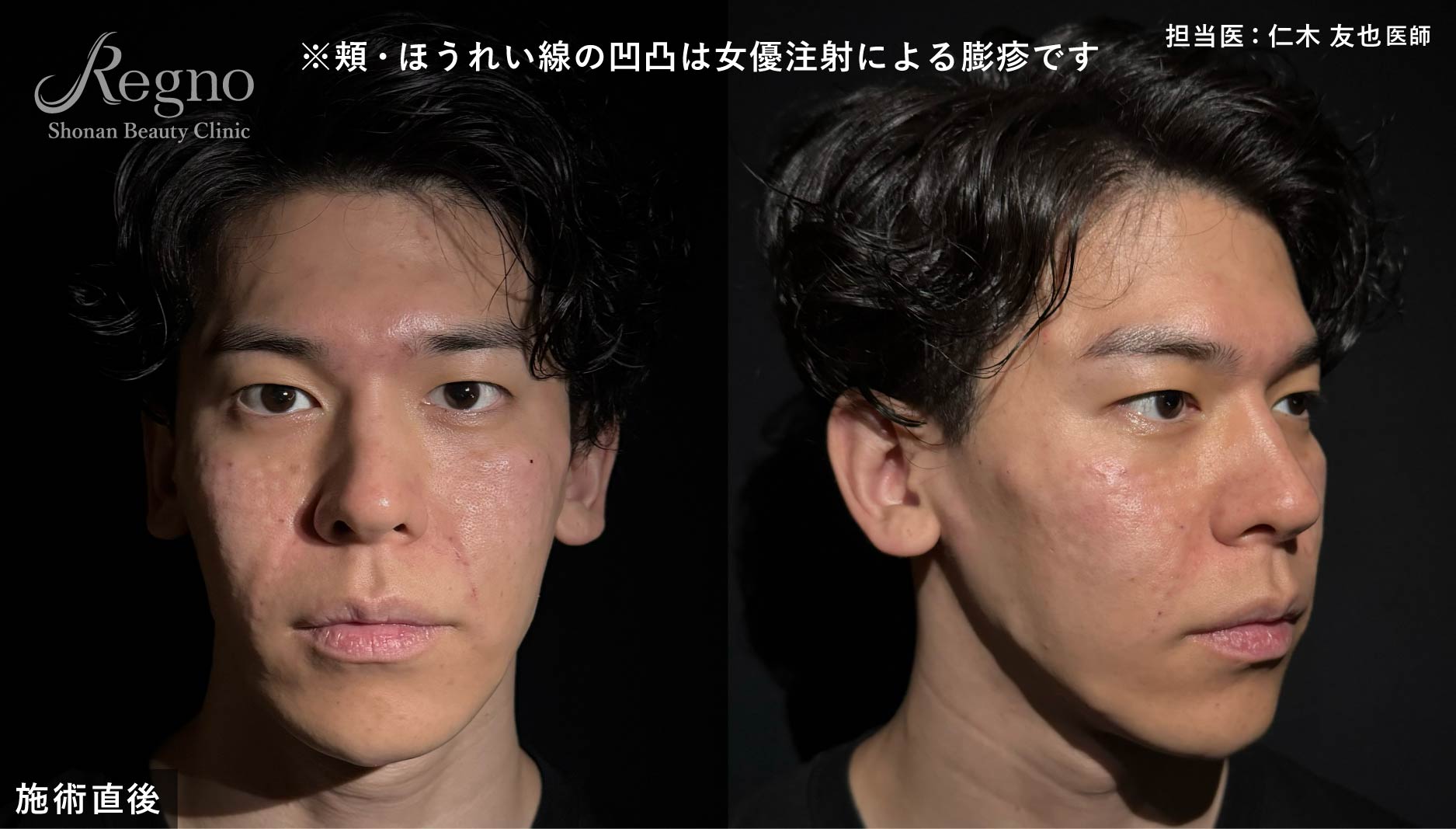 ダウンタイムはあるの？