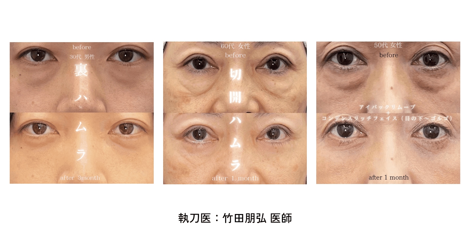 症例数が豊富