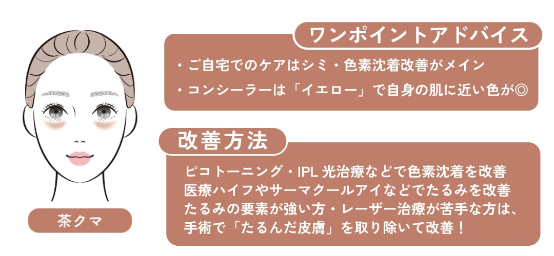 【化粧で隠せるクマ②】茶クマ