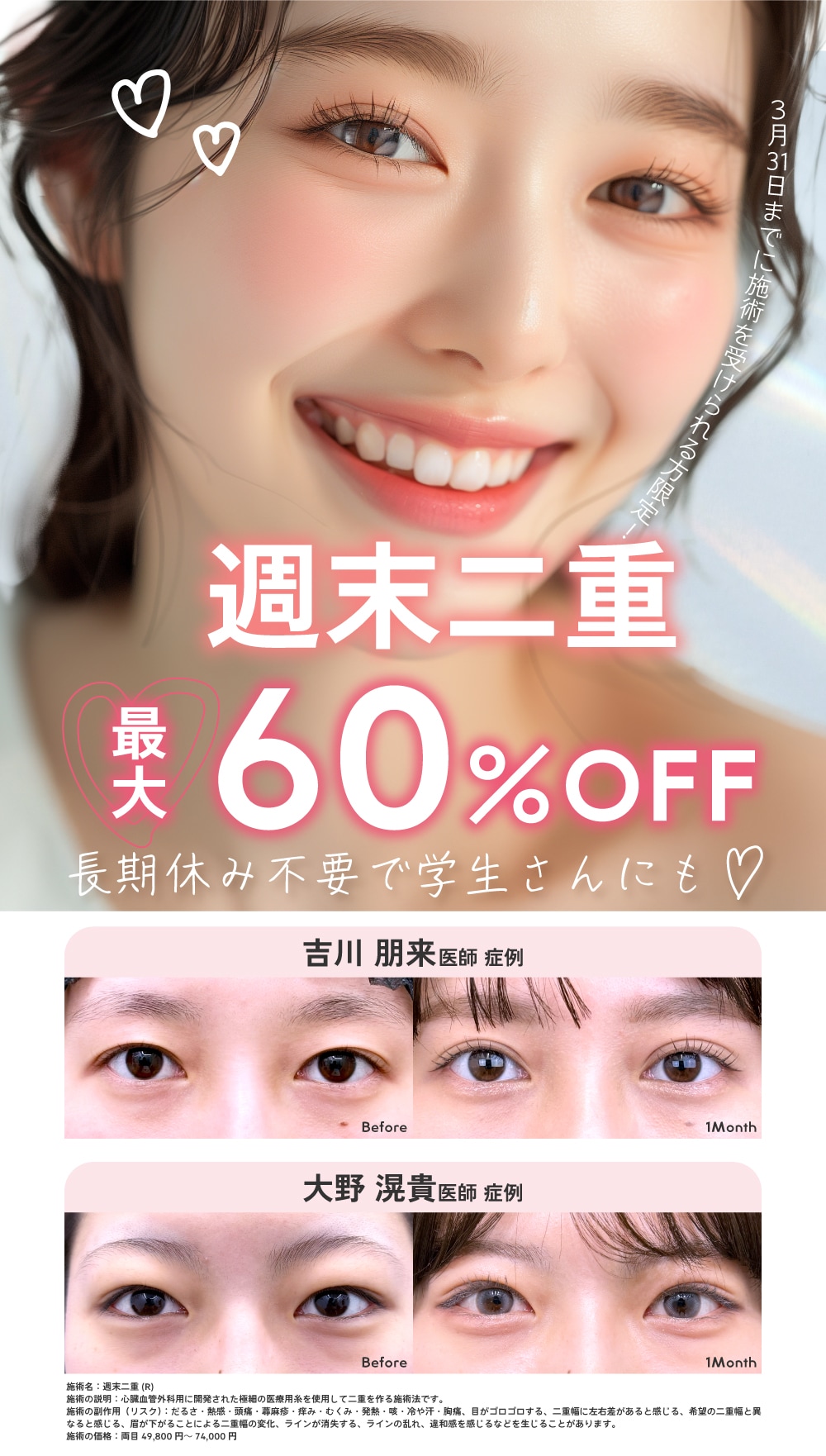 好評につき延長📣週末二重最大60％OFF！！