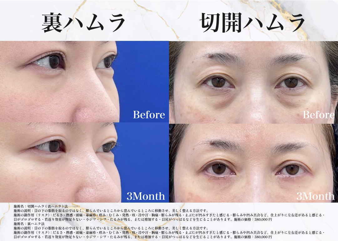 目元若返り