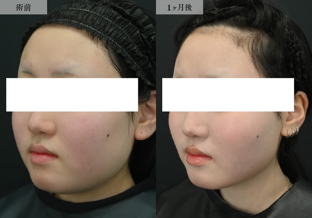 20代・女性