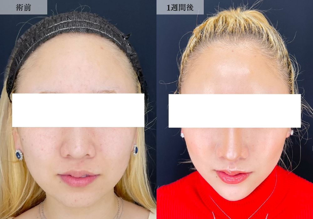 20代・女性