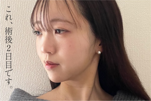 ダウンタイム、痛みが最小限