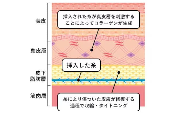 未来のたるみを予防する