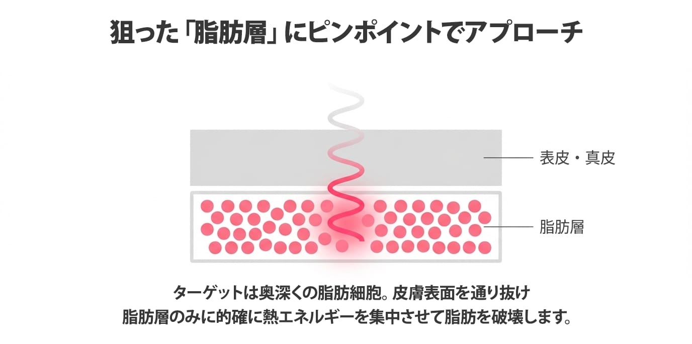 新しい痩身メカニズム