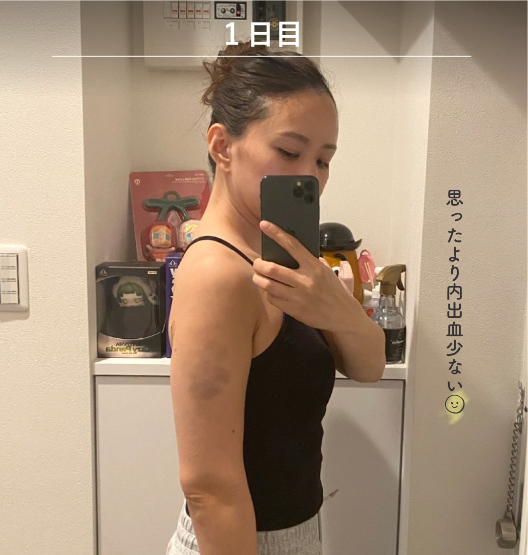 術後1日目