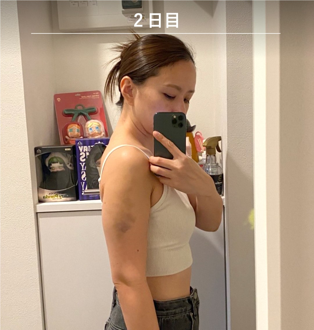 術後2日目