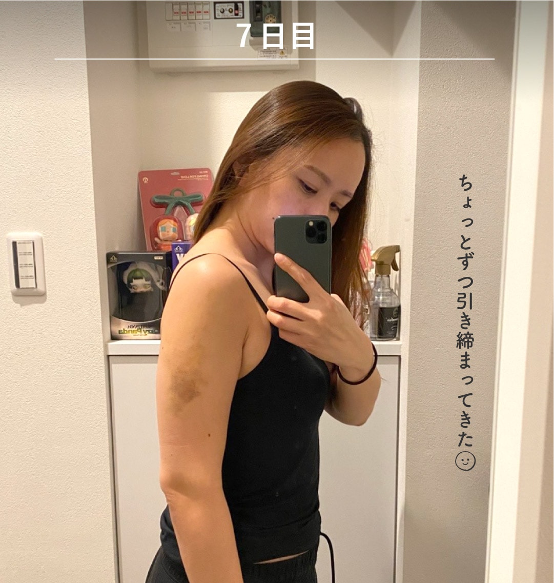 術後7日目