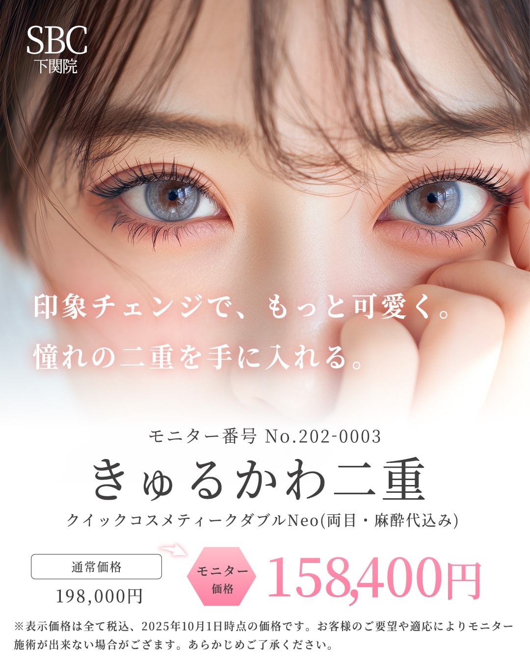 【二重整形】