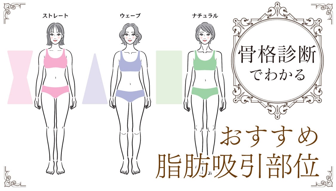 骨格別・おすすめ脂肪吸引✨骨格診断であなたに適した脂肪吸引部位をチェック👀
