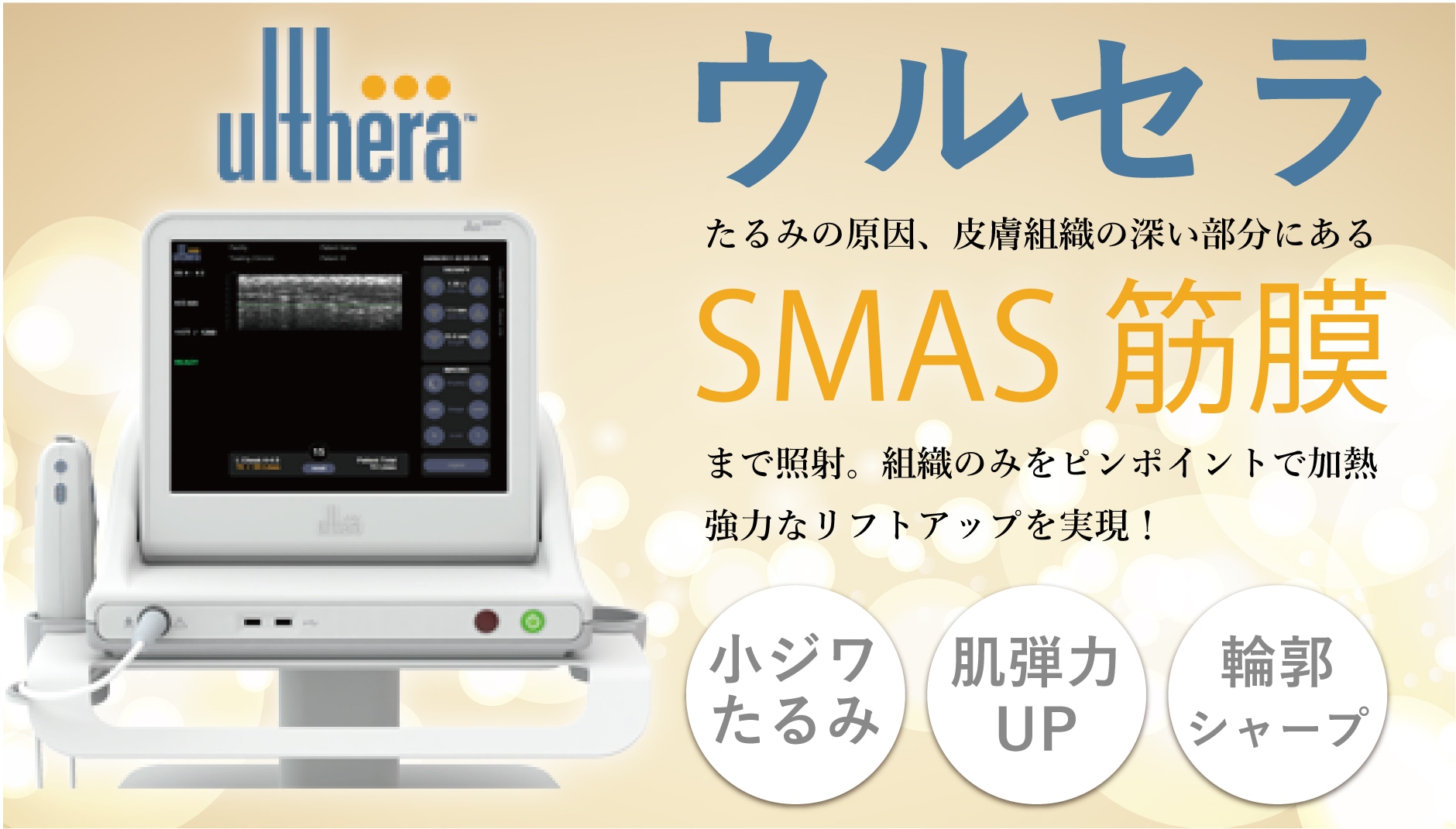 歴史あるウルセラ