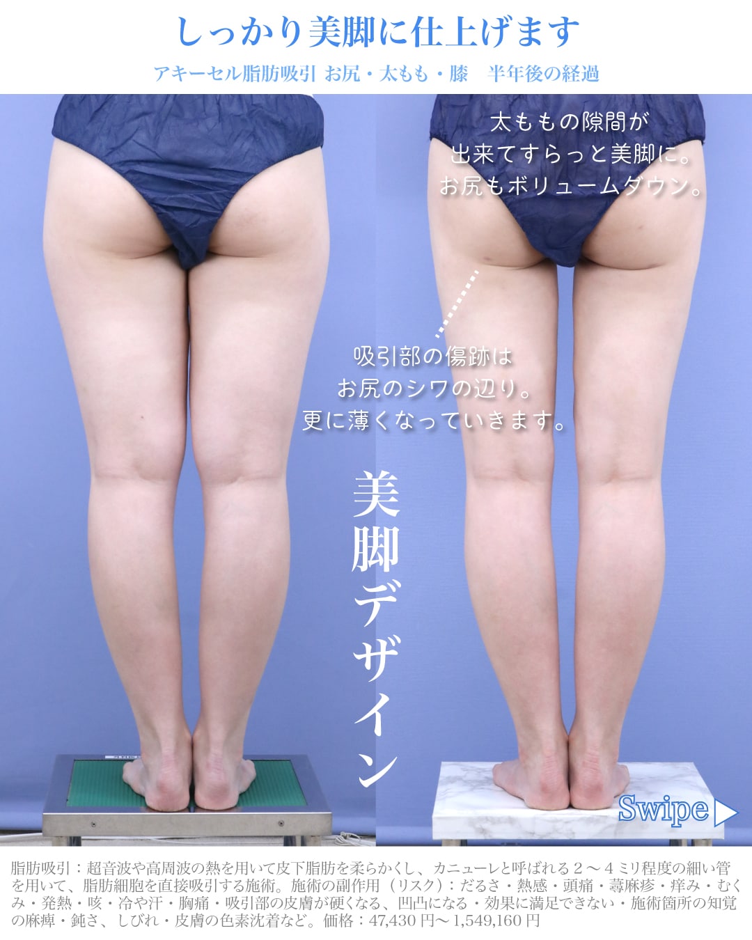 【20代後半女性】お尻をキュッと小さくすると、脚長効果！？