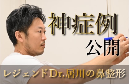 【自然で美しい鼻になりたい方必見】修正総責任者ジョニー居川は技術力の格が違う！