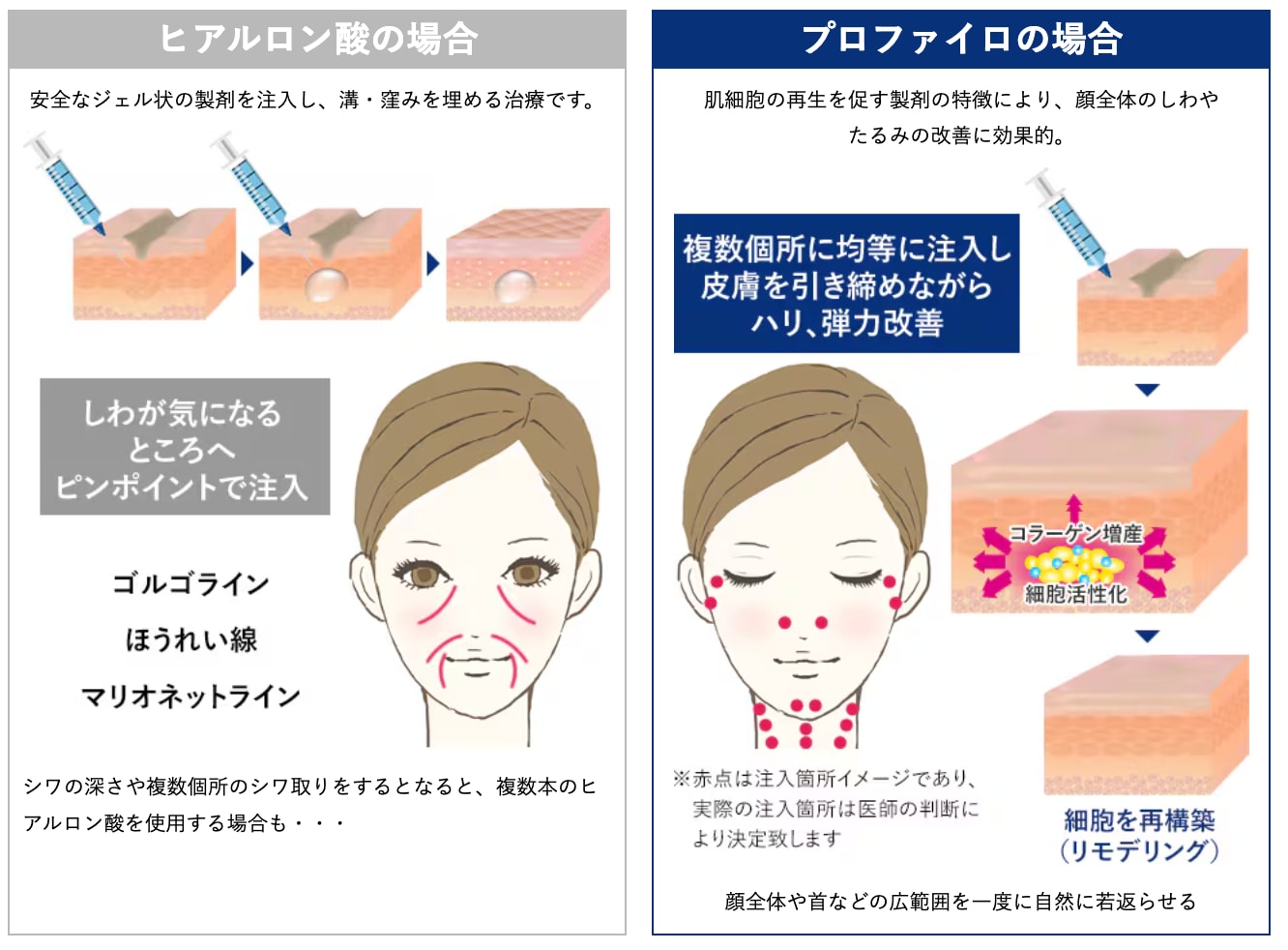 従来のヒアルロン酸となにが違う？