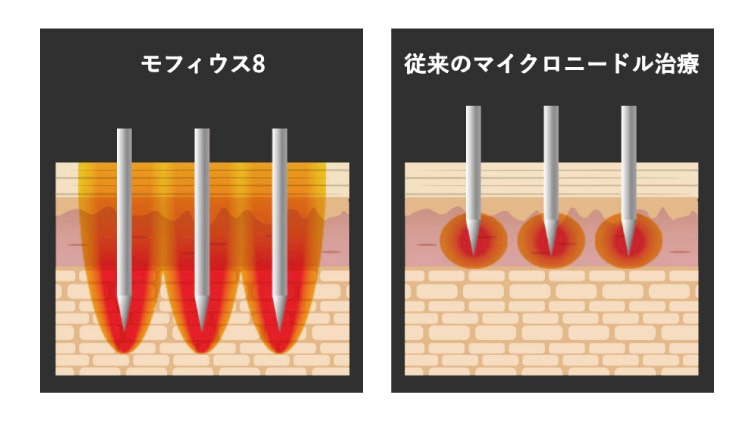 効果の仕組み