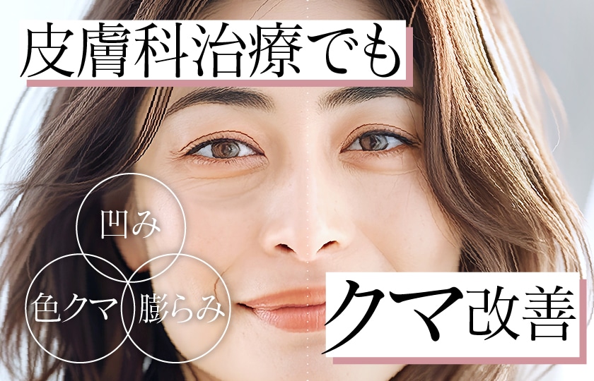 目の下のクマも皮膚科で解決！ モフィウス8×ベビーコラーゲン【皮膚科でクマ取りするなら新宿本院】