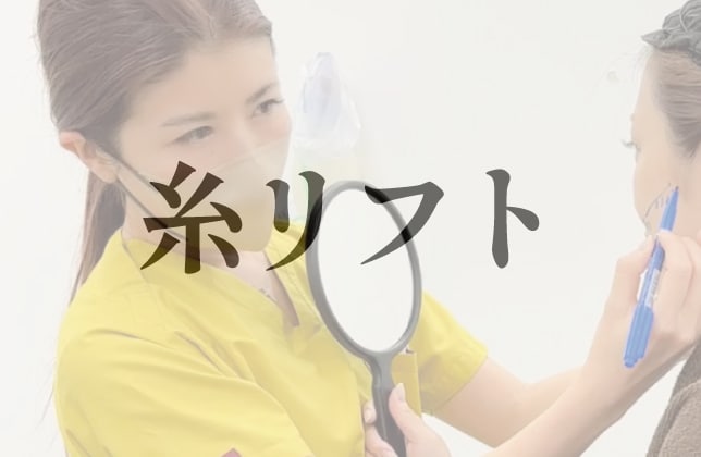 糸リフト