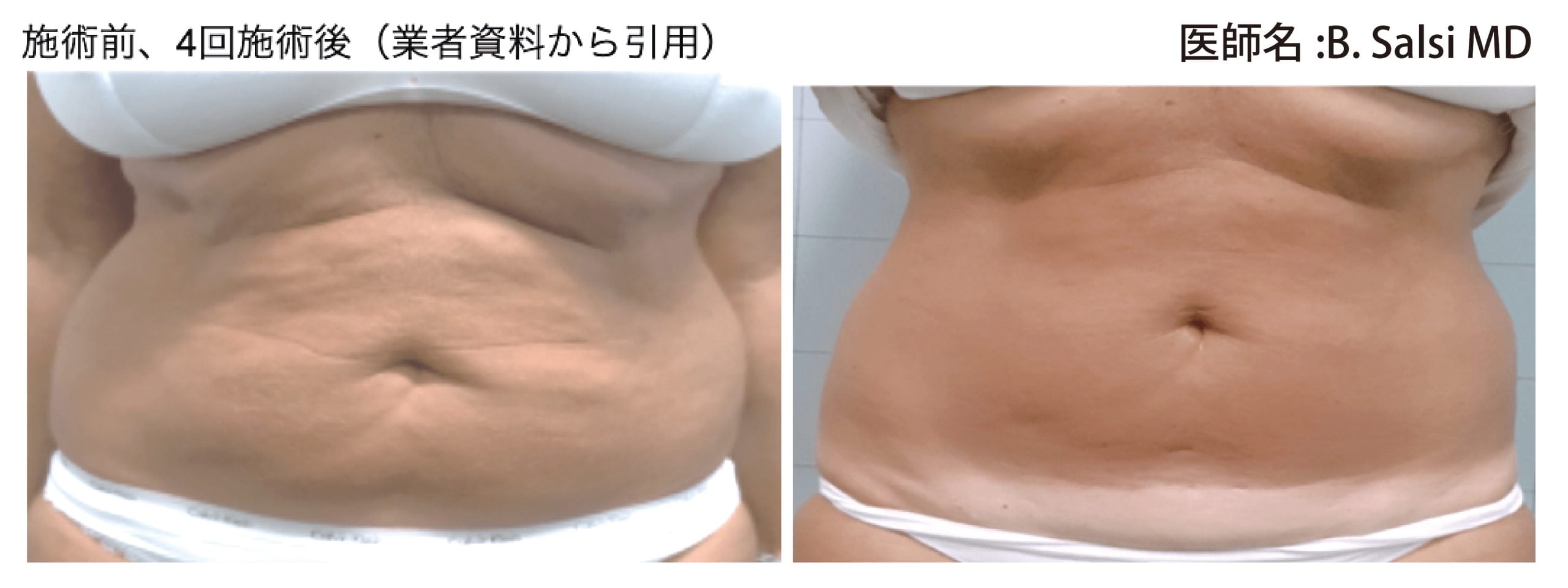 何に効果ある？