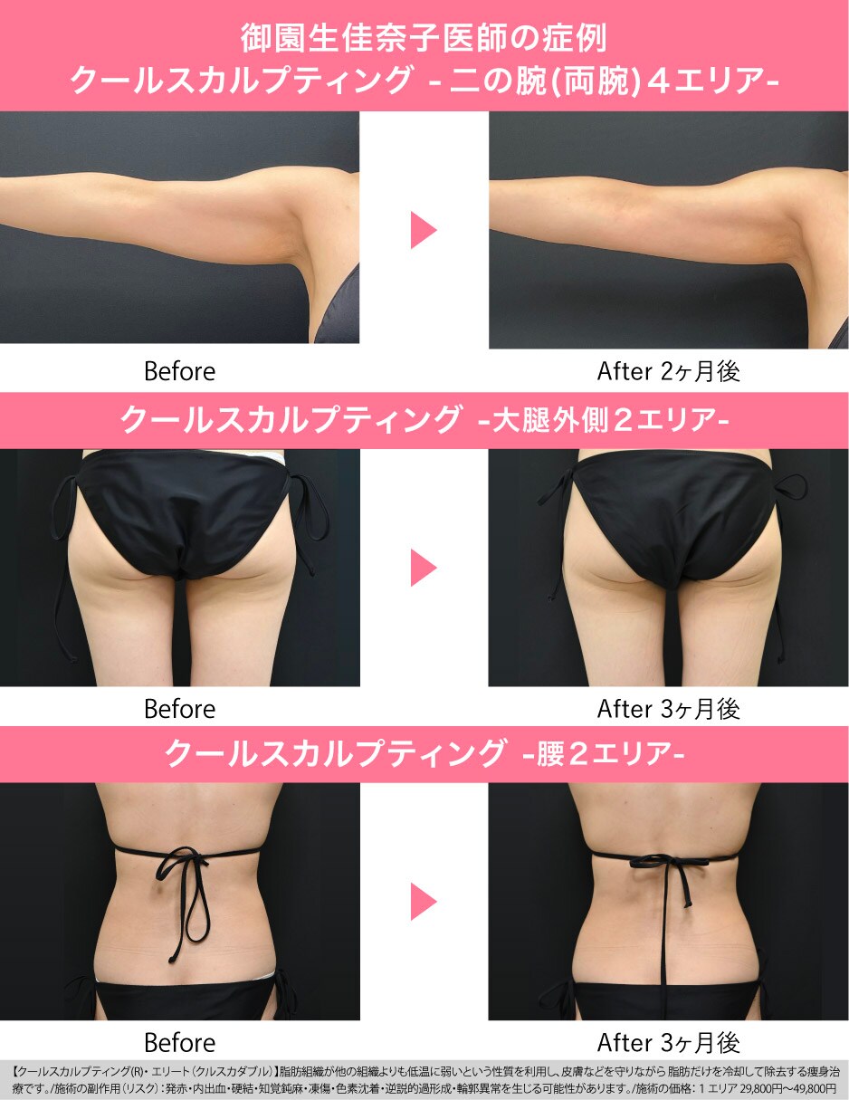脂肪細胞を破壊＆排出する”クルスカダブル”！<br />
