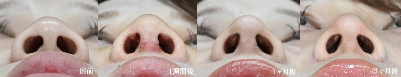 傷跡は目立つ？