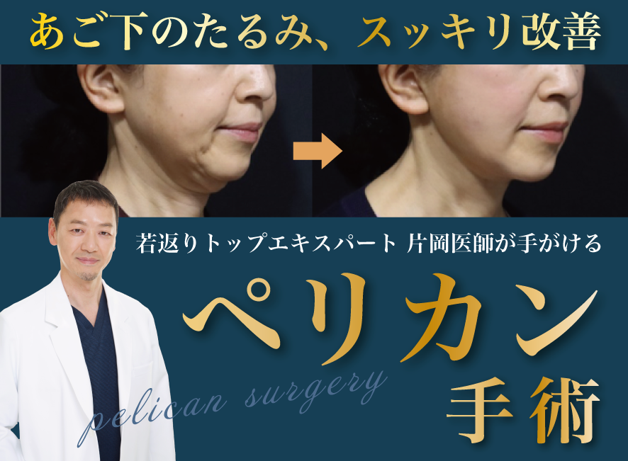 最近よく聞く【ペリカン手術】どんな手術？どんな人が適応？気になる疑問にお答えします！【フェイスリフトならSBC新宿本院 片岡医師】