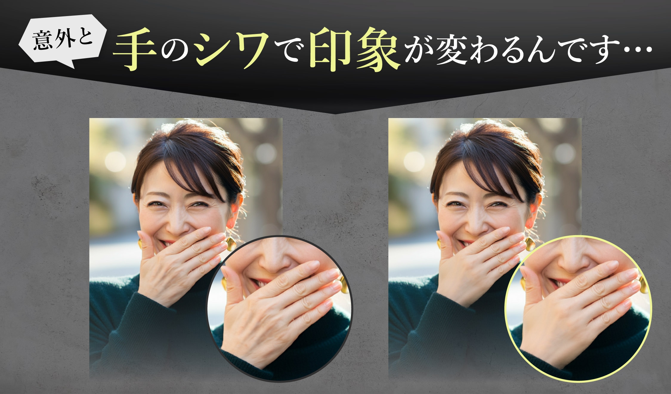 意外と手のシワ・シミで印象が変わるんです…【お顔だけじゃない！体の若返りするなら新宿本院へ】