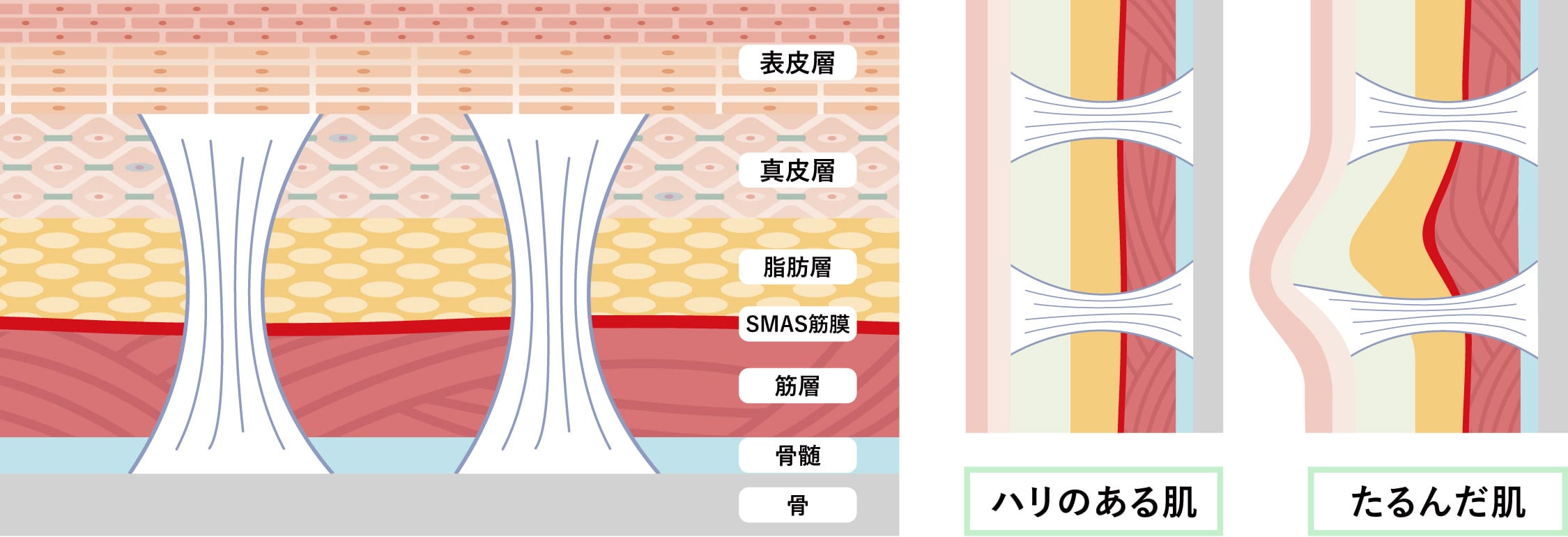 次世代の肌育治療「ジャルプロスーパーハイドロ」